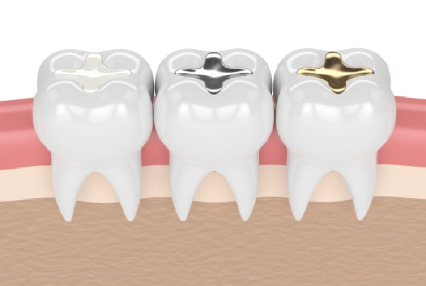 AESHETIC FILLINGS