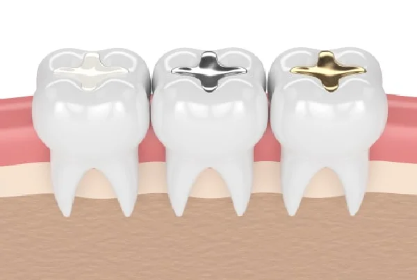 AESHETIC FILLINGS